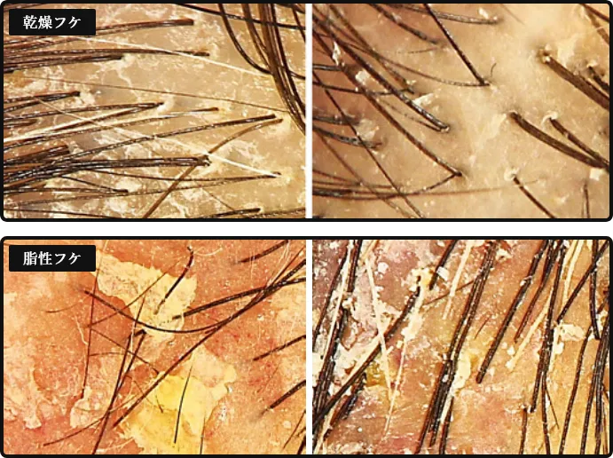 アップルサイダービネガーの利点