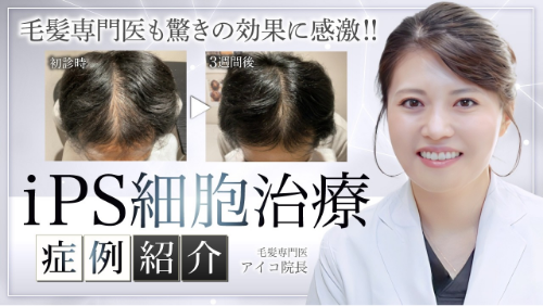 症例2：短期AGA治療の実績