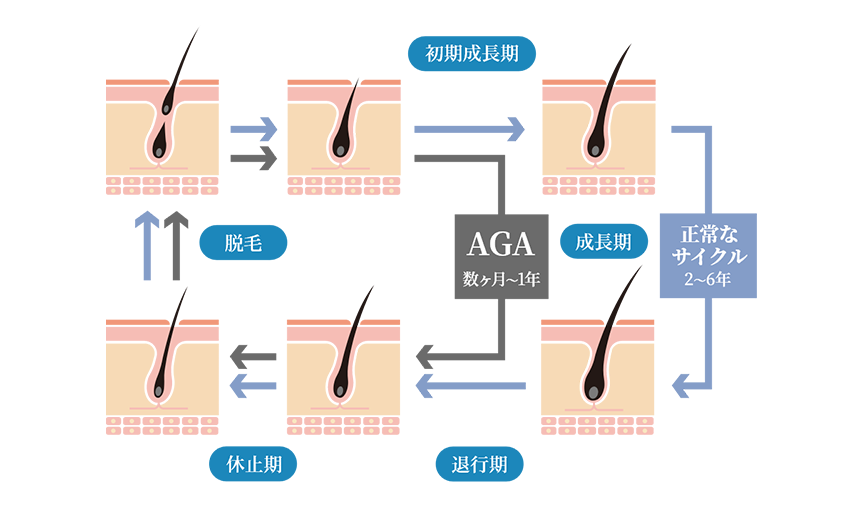 毛髪サイクル