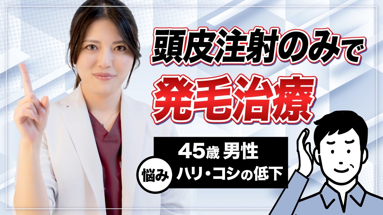 【症例紹介】40代男性のPRP治療症例