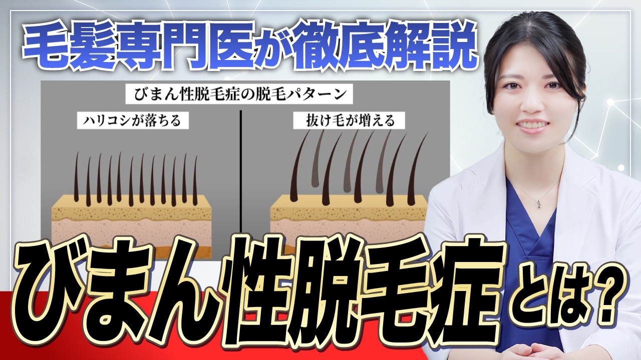 【女性の薄毛】びまん性脱毛症の見分け方とは？