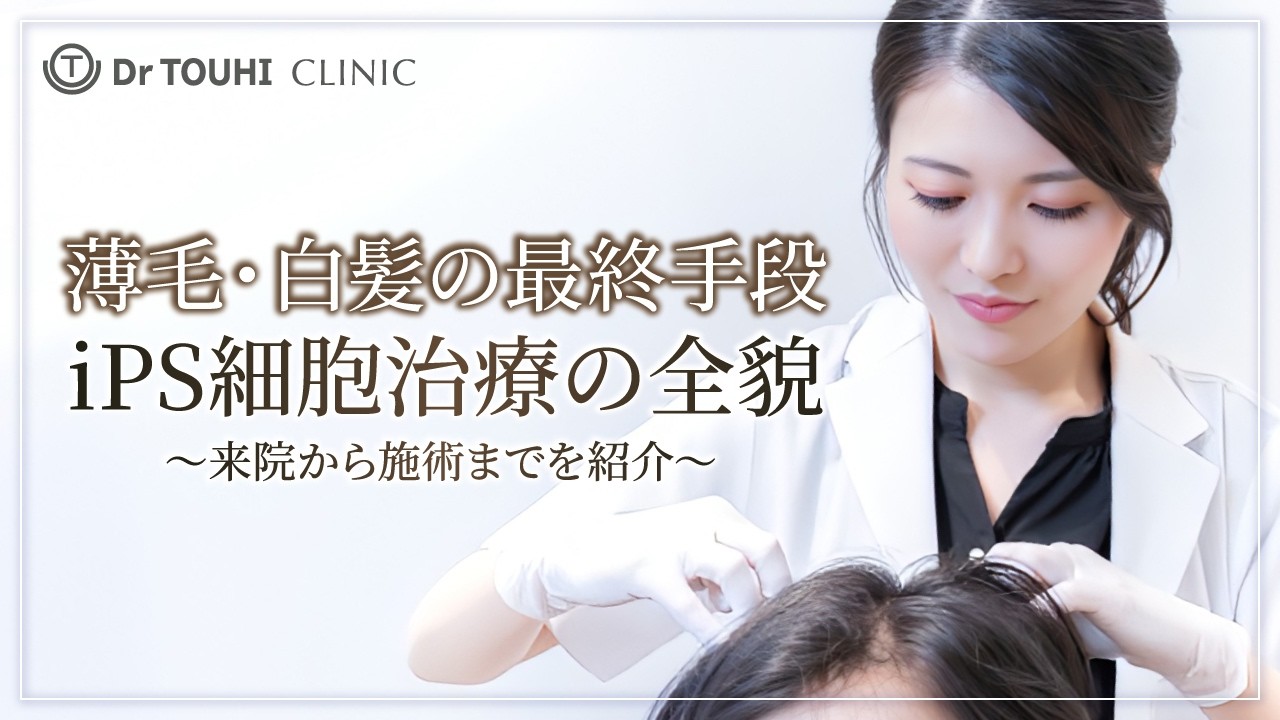 【iPS細胞治療】来院から施術まで完全解説｜薄毛・白髪治療の新たな選択肢【AGA】【白髪】