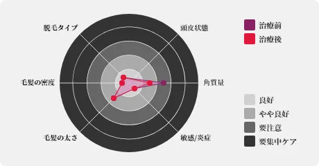 頭皮診断データ