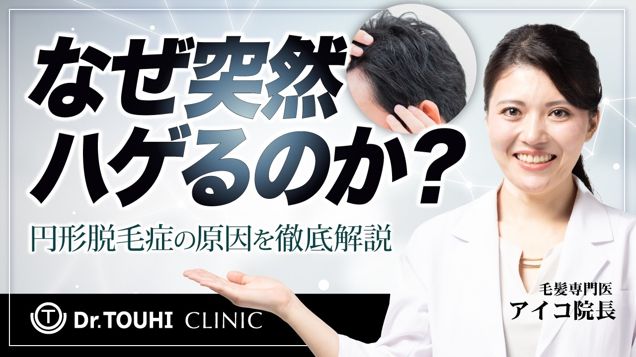 円形脱毛症はなぜ起こる？知られざる原因と最新治療【再生医療】