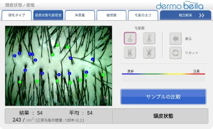 頭皮状態